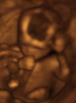 17 weeks, sucking thumb, ultrasound